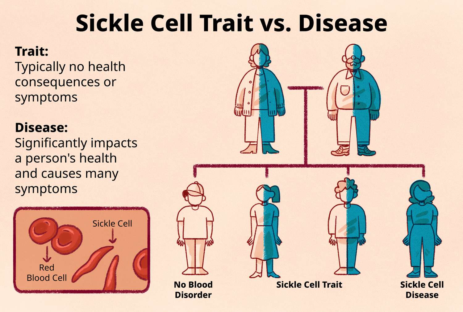 Sickle Cell image